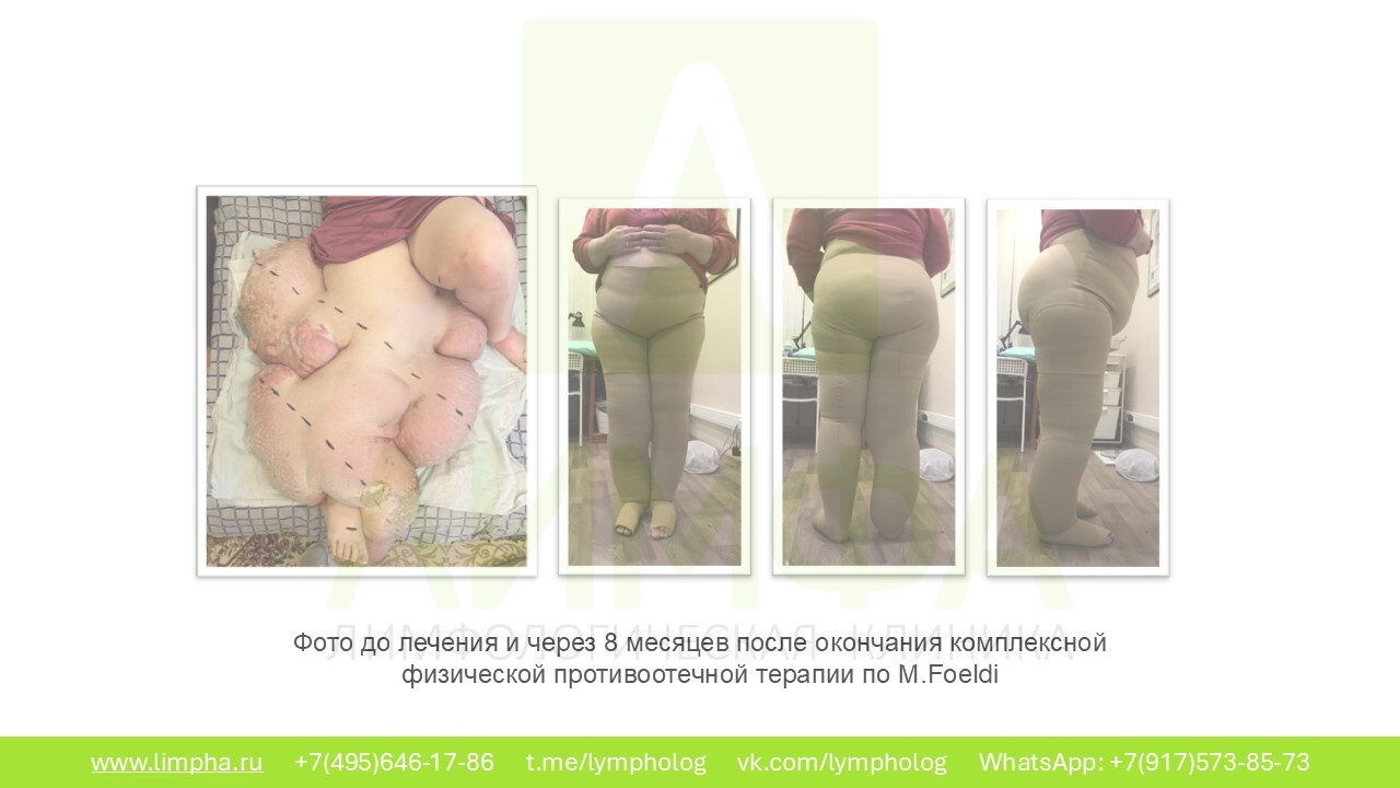 До лечения